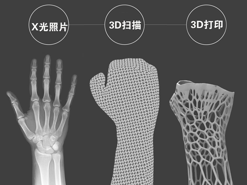 陜西非凡士分享FDM3D打印在醫療行業的應用案例