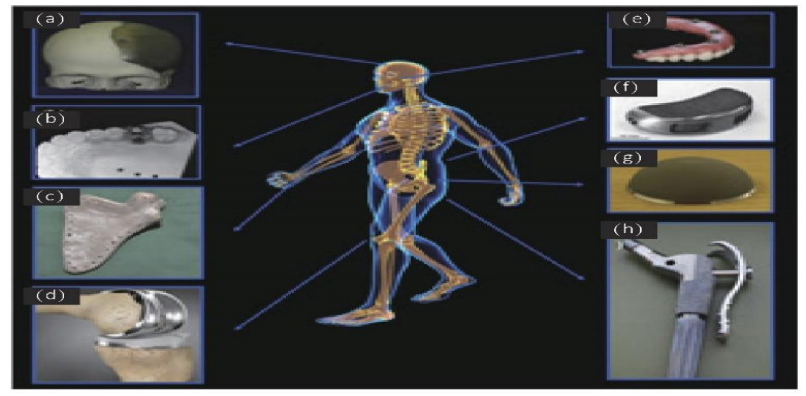 生物醫療：3D打印使個性化醫療成為現實